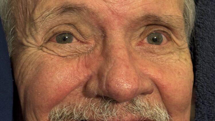 James W. Joyner, age 77